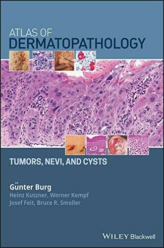 Atlas of Dermatopathology: Tumors, Nevi, and Cysts 1st Edition