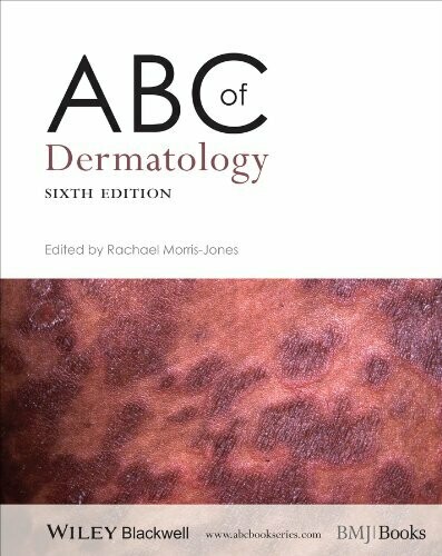 ABC of Dermatology (ABC Series Book 241) 6th Edition