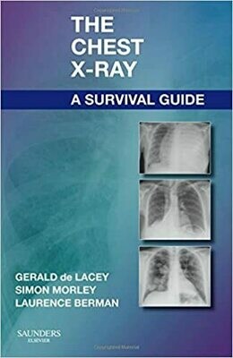 The Chest X-Ray: A Survival Guide 1st Edition