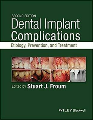Dental Implant Complications: Etiology, Prevention, and Treatment 2nd Edition