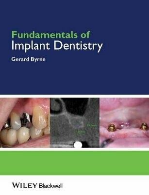 Fundamentals of Implant Dentistry 1st Edition