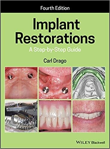 Implant Restorations: A Step-by-Step Guide 4th Edition