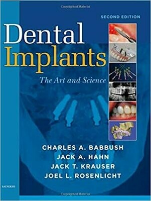 Dental Implants: The Art and Science 2nd Edition