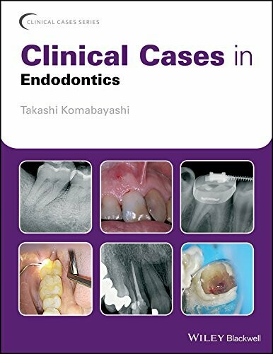 Clinical Cases in Endodontics 1st Edition