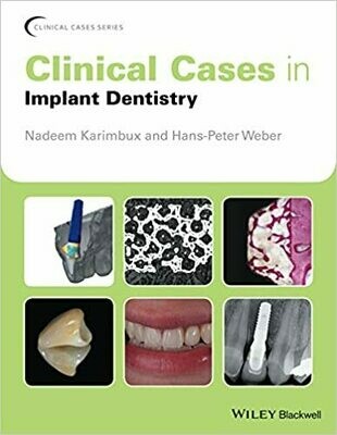 Clinical Cases in Implant Dentistry 1st edition