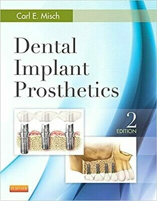 Dental Implant Prosthetics 2nd Edition