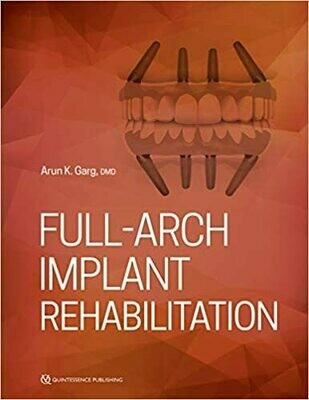 Full-Arch Implant Rehabilitation 1st Edition