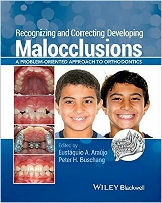 Recognizing and Correcting Developing Malocclusions: A Problem-Oriented Approach to Orthodontics 1st Edition