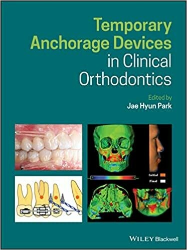 Temporary Anchorage Devices in Clinical Orthodontics 1st Edition