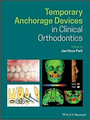 Temporary Anchorage Devices in Clinical Orthodontics 1st Edition