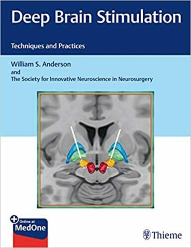 Deep Brain Stimulation 1st Edition