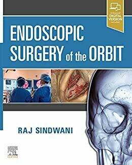 Endoscopic Surgery of the Orbit E-Book 1st Edition