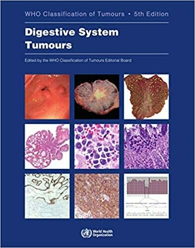 Digestive System Tumours: WHO Classification of Tumours 5th Edition