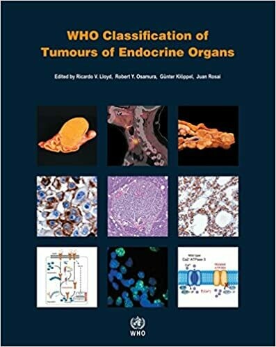 WHO Classification of Tumors of Endocrine Organs 4th Edition