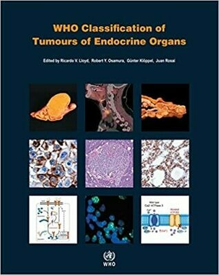 WHO Classification of Tumors of Endocrine Organs 4th Edition