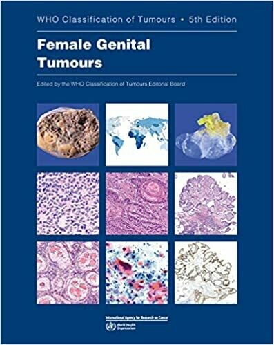 Female Genital Tumours: WHO Classification of Tumours 5th Edition