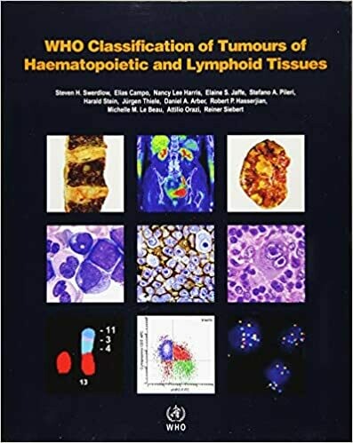 WHO Classification of Tumors of Haematopoietic and Lymphoid Tissues 4th Edition 2017