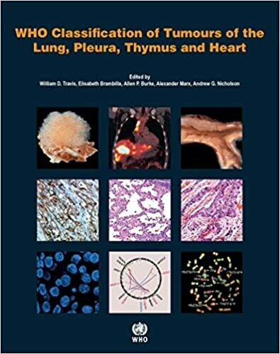WHO Classification of Tumours of the Lung, Pleura, Thymus and Heart 4th Edition