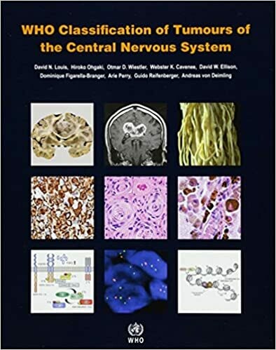 WHO Classification of Tumours of the Central Nervous System 4th Edition