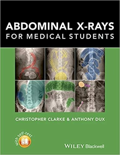 Abdominal X-rays for Medical Students 1st Edition