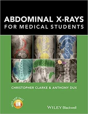 Abdominal X-rays for Medical Students 1st Edition