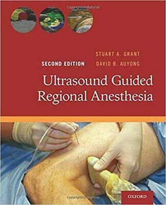 Ultrasound Guided Regional Anesthesia 2nd Edition