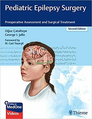 Pediatric Epilepsy Surgery: Preoperative Assessment and Surgical Treatment 2nd Edition