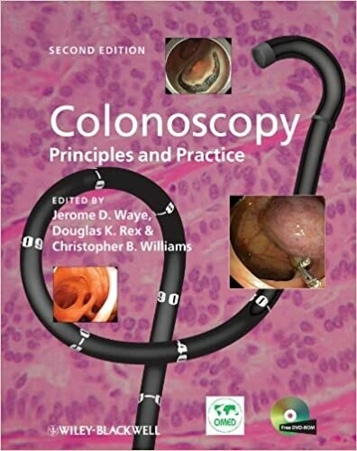 Colonoscopy: Principles and Practice 2nd Edition
