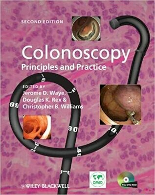 Colonoscopy: Principles and Practice 2nd Edition
