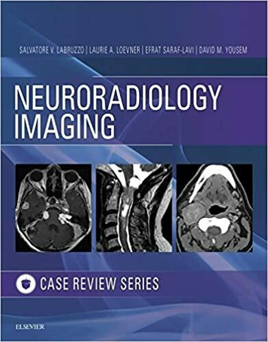 Neuroradiology Imaging Case Review 1st Edition