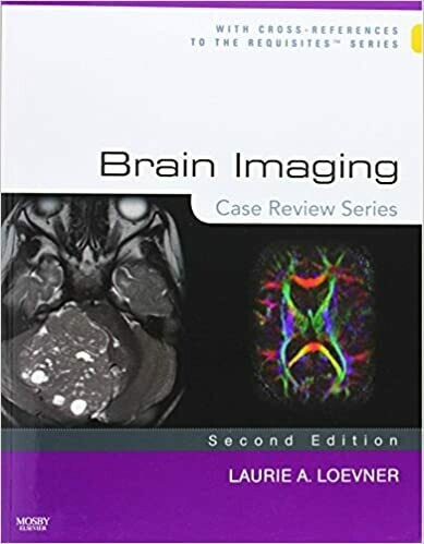 Brain Imaging: Case Review Series 2nd Edition