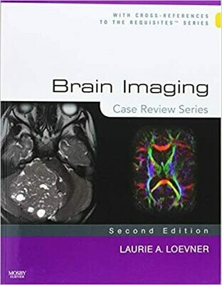 Brain Imaging: Case Review Series 2nd Edition