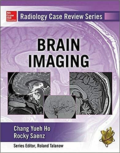 Radiology Case Review Series: Brain Imaging 1st Edition