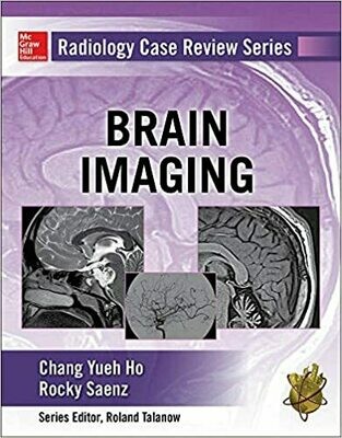 Radiology Case Review Series: Brain Imaging 1st Edition