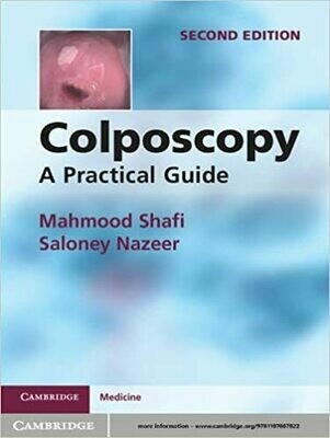 Colposcopy: A Practical Guide 2nd Edition