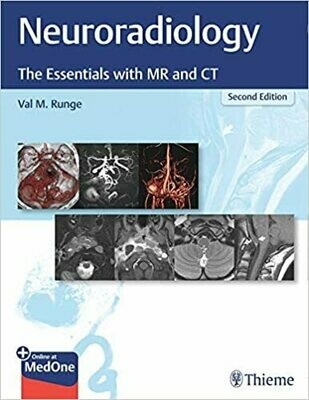 Neuroradiology (The Essentials with MR and CT) 2nd Edition
