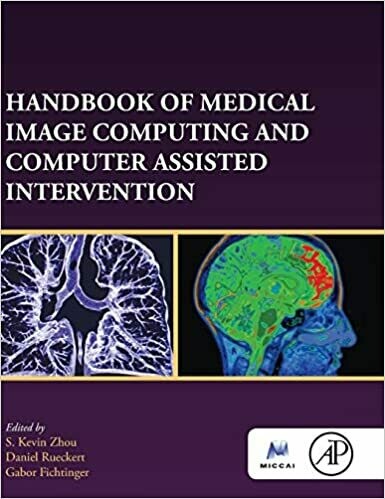 Handbook of Medical Image Computing and Computer Assisted Intervention 1st Edition