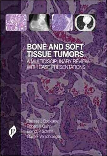 Bone and Soft Tissue Tumours: A Multidisciplinary Review With Case Presentations 1st Edition