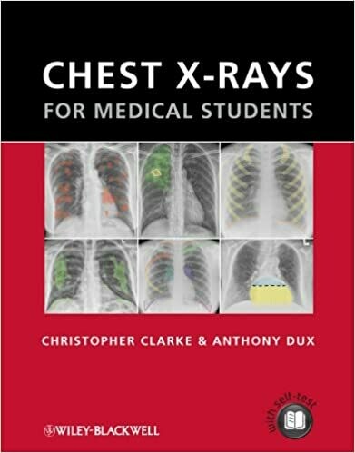 Chest X-rays for Medical Students 1st Edition