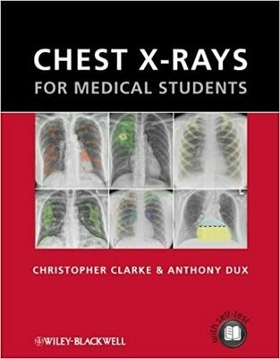 Chest X-rays for Medical Students 1st Edition