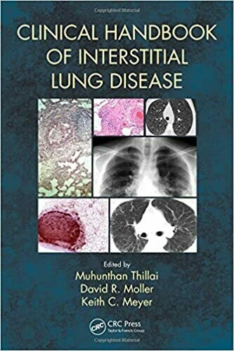 Clinical Handbook of Interstitial Lung Disease 1st Edition