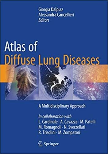 Atlas of Diffuse Lung Diseases: A Multidisciplinary Approach 1st edition