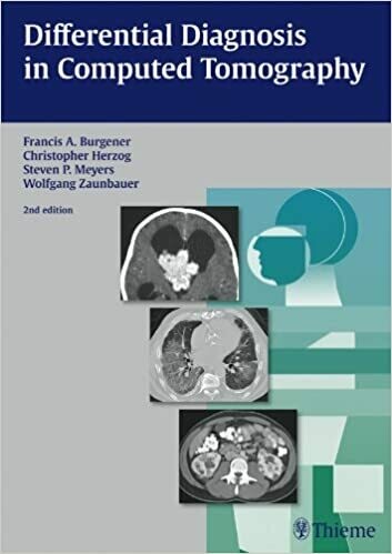 Differential Diagnosis in Computed Tomography 2nd Edition