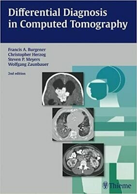 Differential Diagnosis in Computed Tomography 2nd Edition