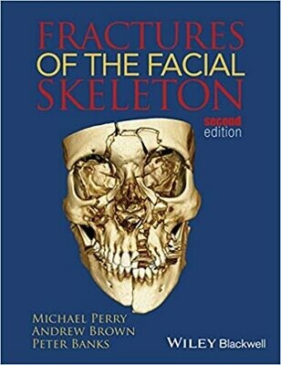 Fractures of the Facial Skeleton 2nd Edition