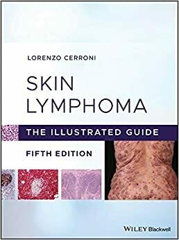 Skin Lymphoma: The Illustrated Guide 5th Edition
