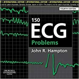 150 ECG Problems