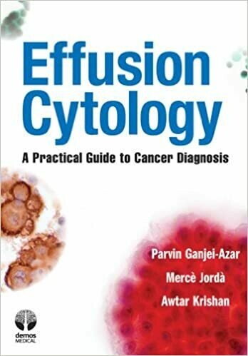 Effusion Cytology: A Practical Guide to Cancer Diagnosis 1st Edition