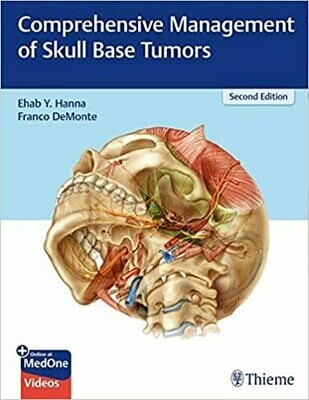 Comprehensive Management of Skull Base Tumors 2nd Edition