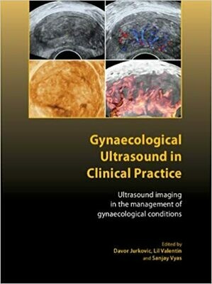 Gynaecological Ultrasound in Clinical Practice: Ultrasound Imaging in the Management of Gynaecological Conditions 1st Edition